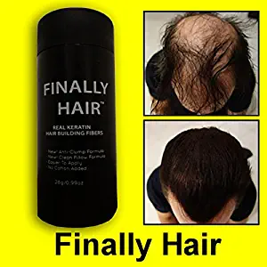 Hair Building Fibers Light Medium Brown Hair Loss Concealer Fiber 28 Gram .99oz Refillable Bottle by Finally Hair (Light Medium Brown - our lightest brown shade)